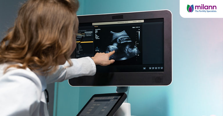 What Is an Anomaly Scan and What Can It Detect in Pregnancy?
